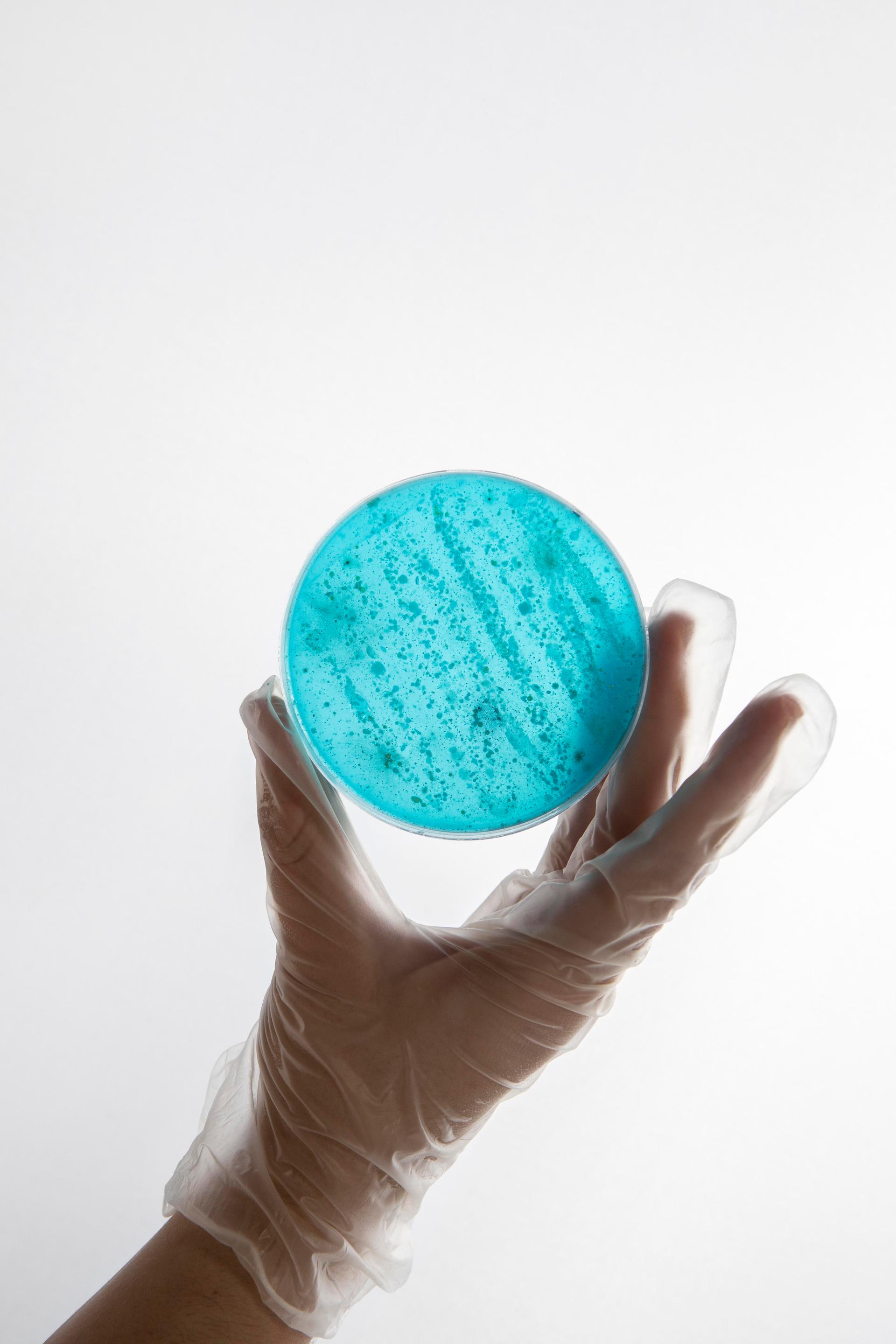 MICROBIOLOGY EXAMINATION