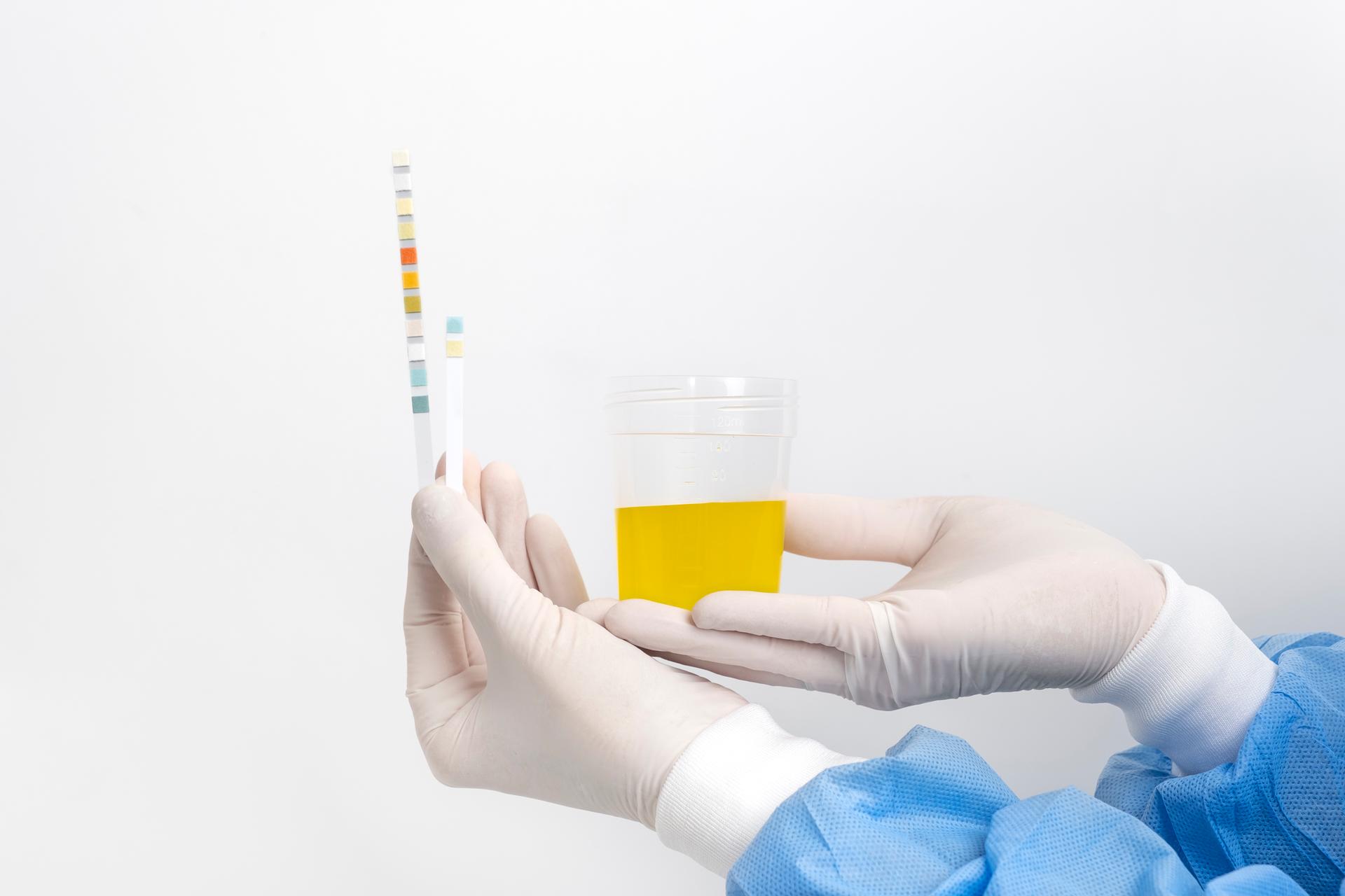 URINALYSIS EXAMINATION